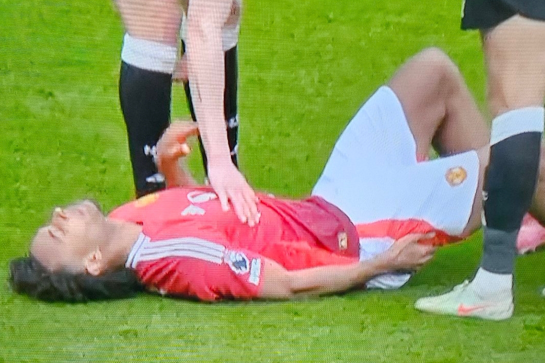 MU nhận tin sét đánh về Joshua Zirkzee trước trận gặp Lyon